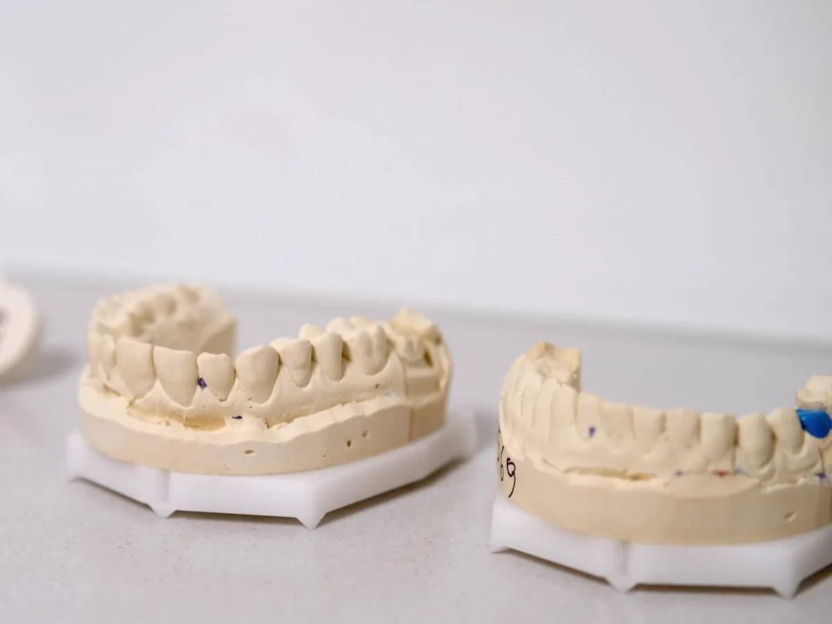 Row of stone dental models on a lab bench
