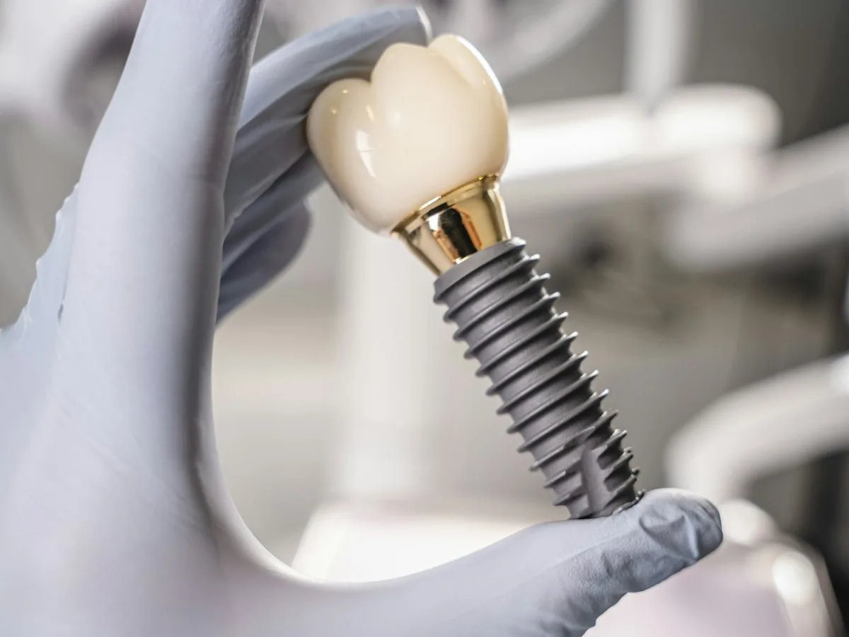 Gloved hand holding an implant crown up for inspection